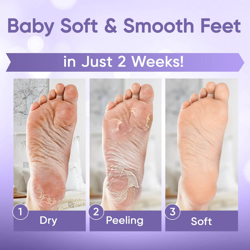 CÉLOR Foot Peel Mask booties on feet ready for an at-home spa.