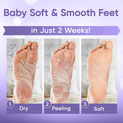 CÉLOR Foot Peel Mask booties on feet for quick, mess-free foot renewal.