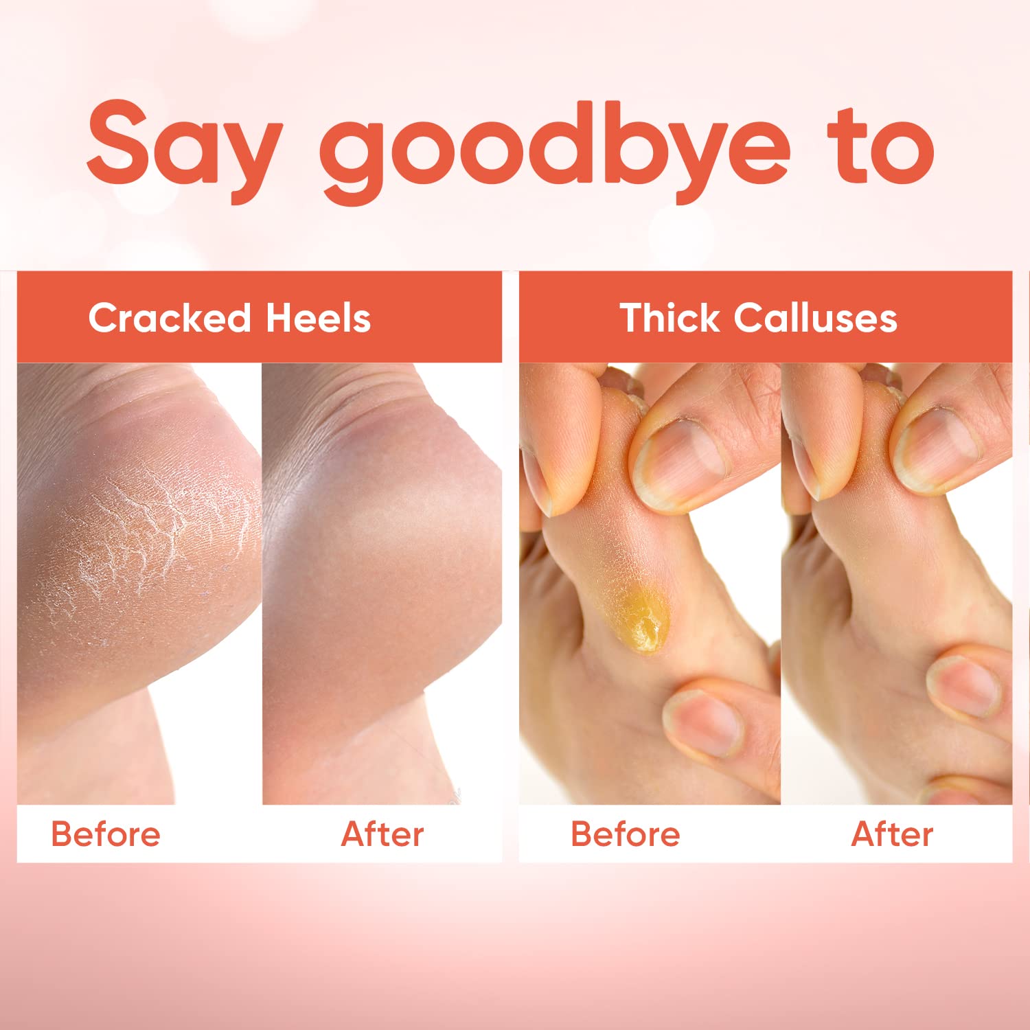 CÉLOR finished feet appear smoother and baby-soft after using the mask.