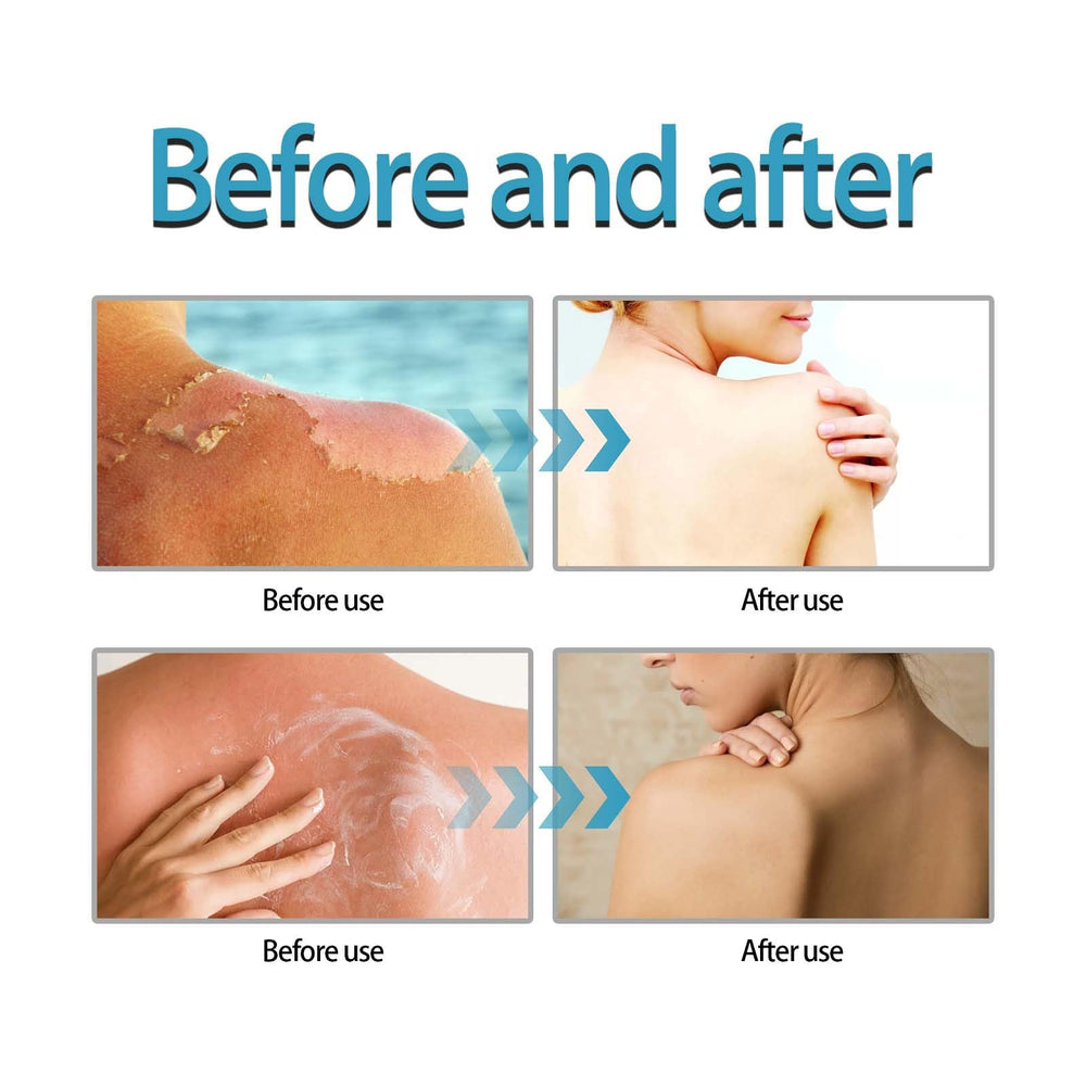 Centella Sunscreen lightweight texture picture communicates smooth application that feels comfortable.