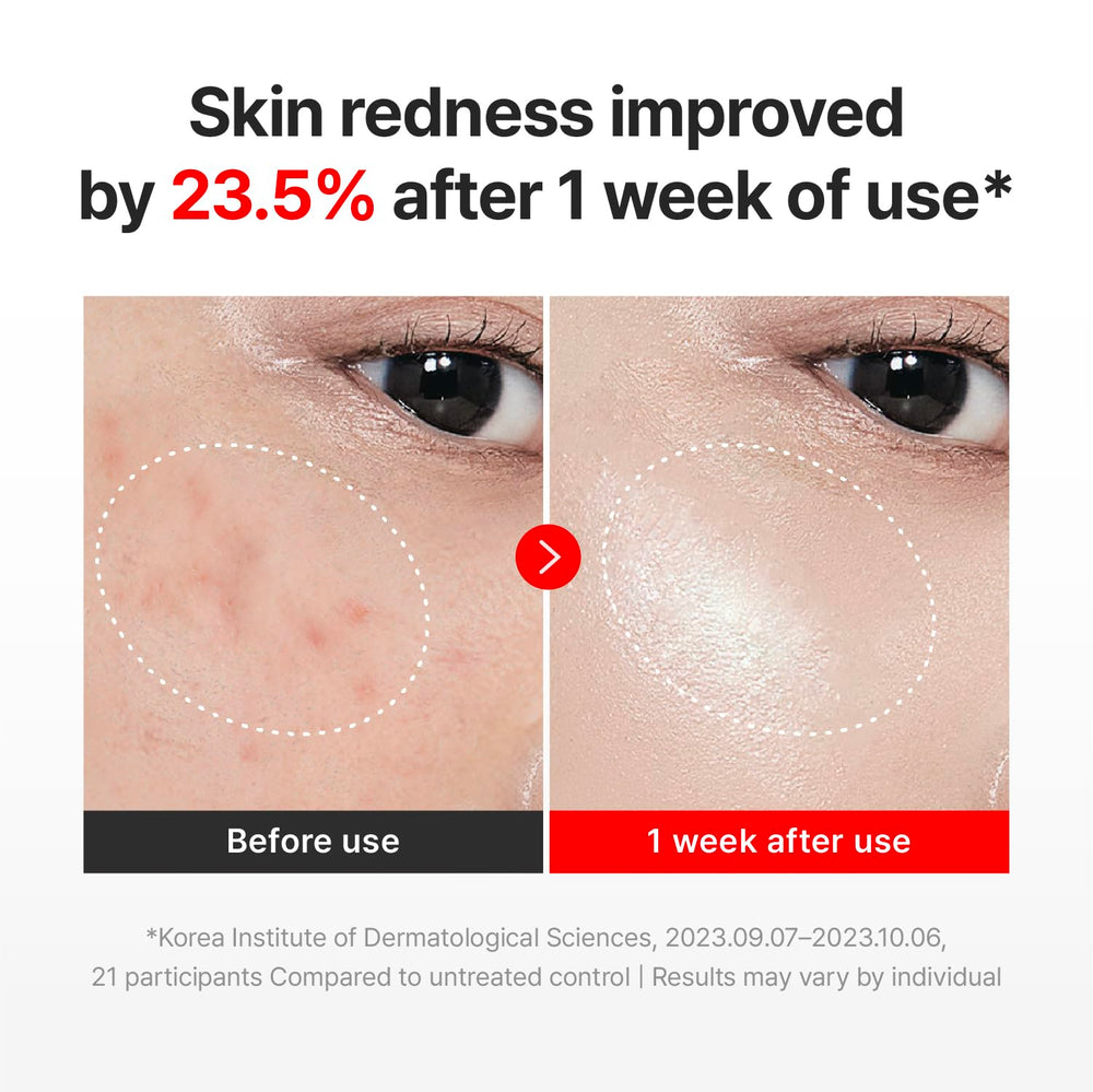 Applying Centellian24 Madeca Cream Time Reverse during skincare routine