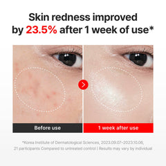 Applying Centellian24 Madeca Cream Time Reverse during skincare routine