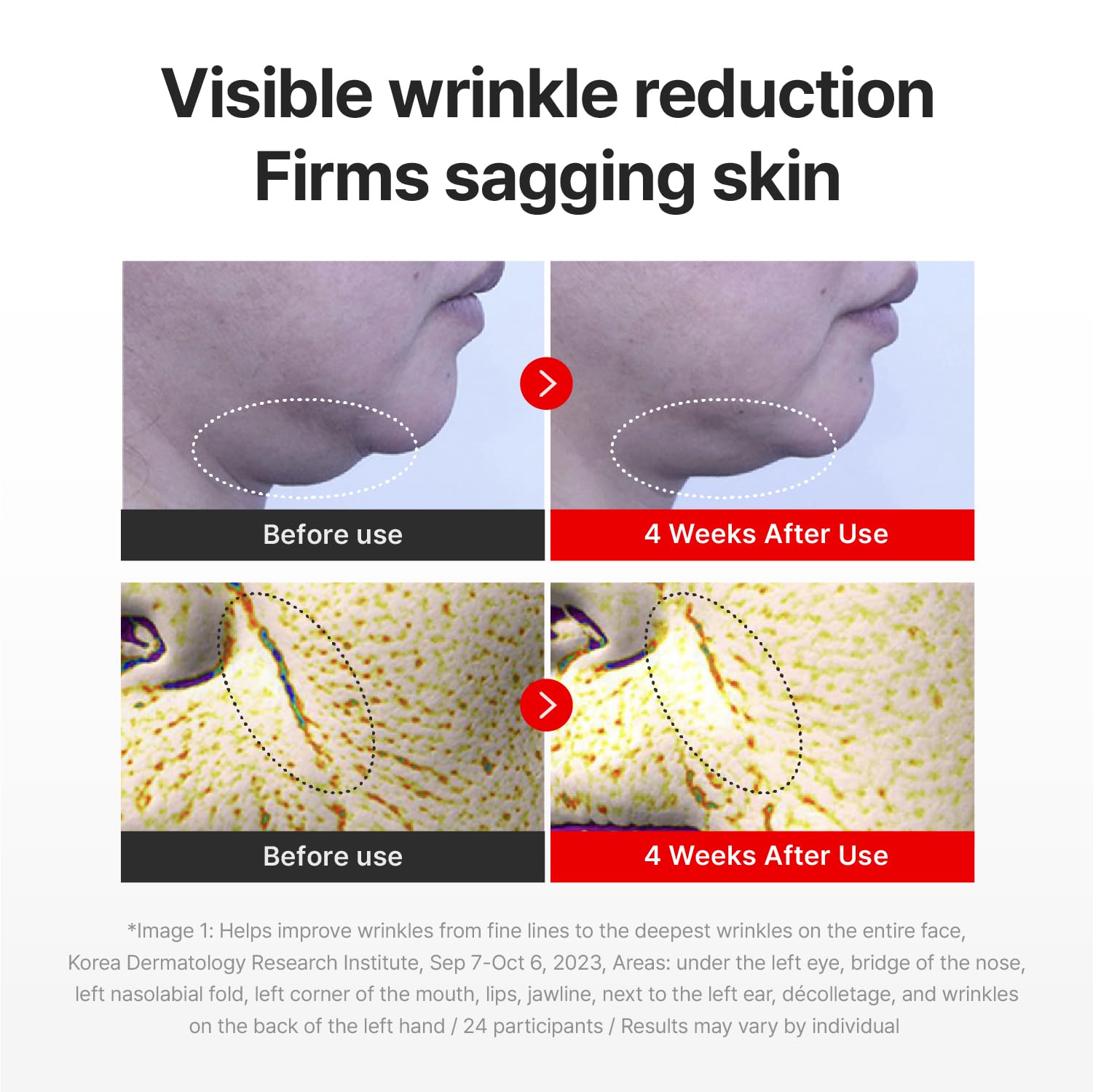 Close-up of skin after use with Centellian24 Madeca Cream Time Reverse