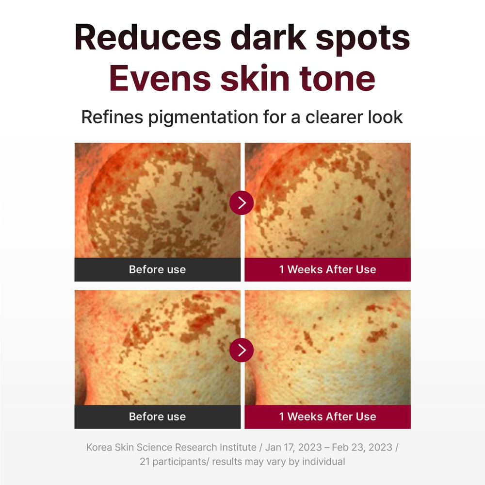 CENTELLIAN 24 Madeca Mela Capture Ampoule Pad application detail highlighting melanin-targeting concept.