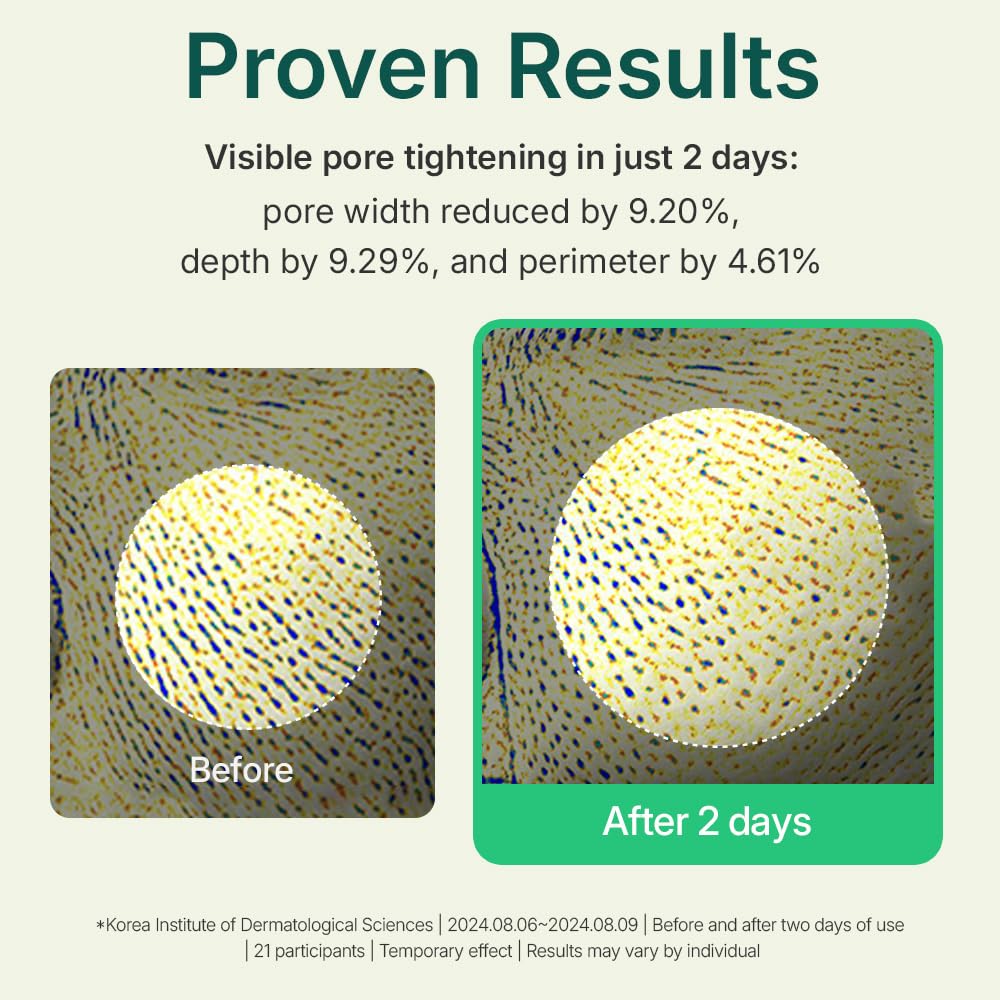 Centellian 24 Madeca Powder Tea Tree AC application image demonstrates easy application as spot care.