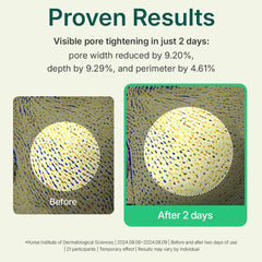 Centellian 24 Madeca Powder Tea Tree AC application image demonstrates easy application as spot care.