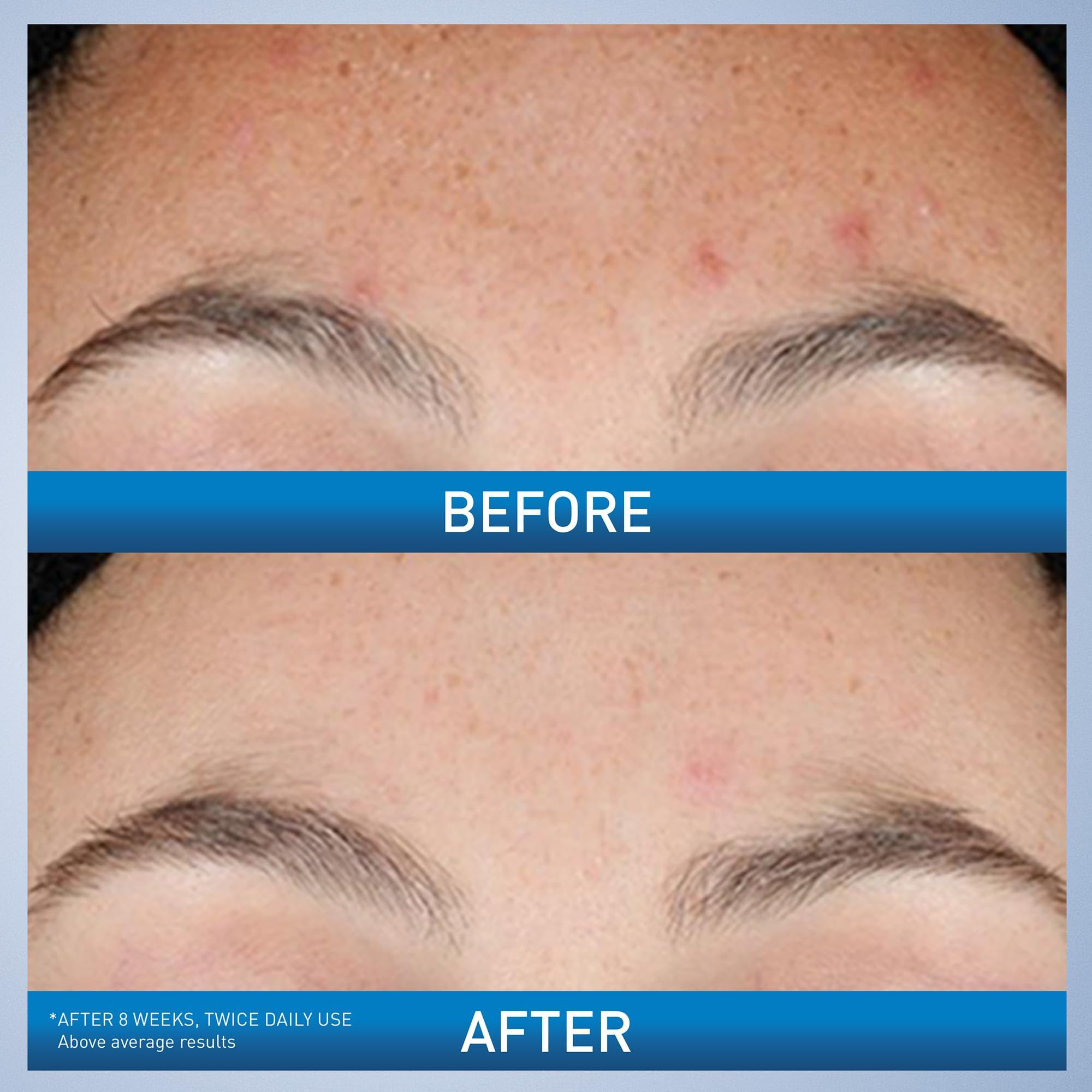CeraVe serum texture spread on fingertip, fast-absorbing and lightweight feel