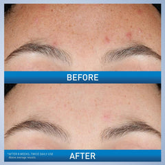 CeraVe serum texture spread on fingertip, fast-absorbing and lightweight feel