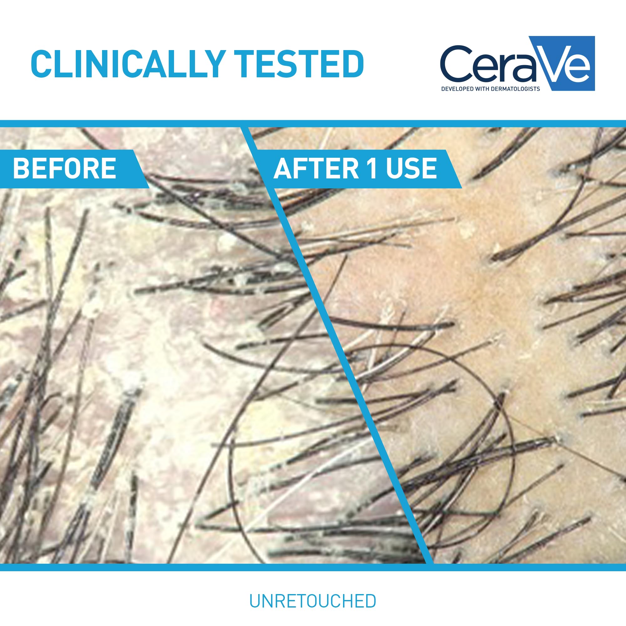 CeraVe shampoo lather close-up demonstrating gentle foam