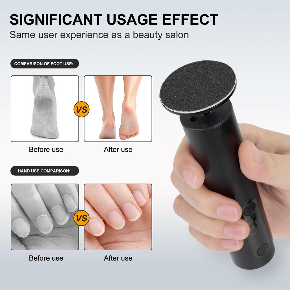 Cesekao Obsidian LED display highlights speed levels for precise callus care.