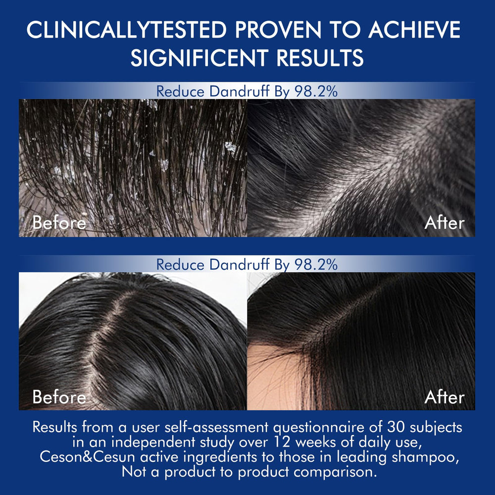 Ceson&Cesun rosemary sulfate-free and paraben-free bottle signals gentle care.