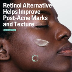 Cetaphil Bakuchiol plant-derived retinol alternative emphasizing gentle renewal for uneven texture.