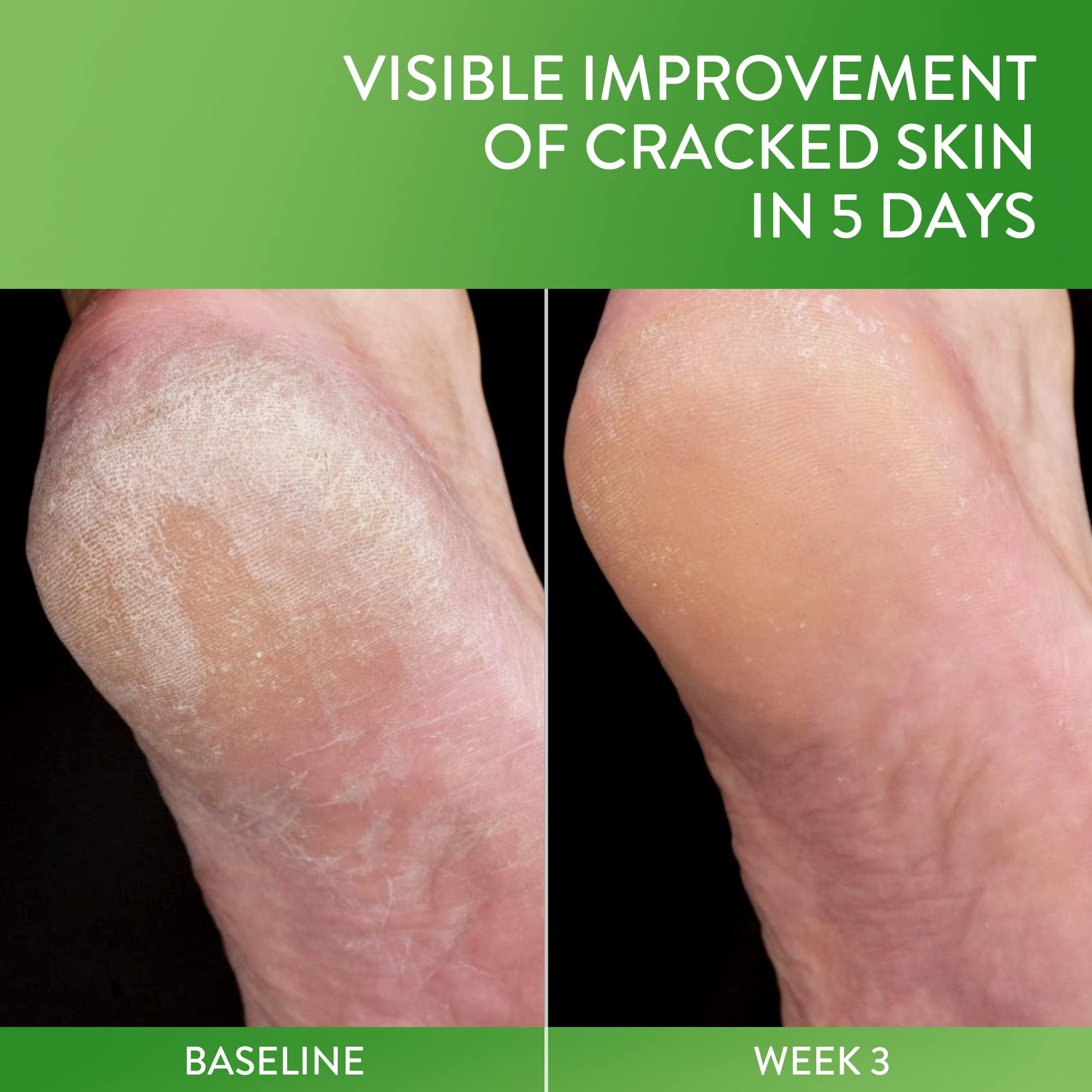 Cetaphil Cracked Skin Repair Balm glycerin hydration visibly softens rough skin.