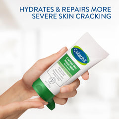 Cetaphil Cracked Skin Repair Balm on heel illustrating deep crack repair potential.