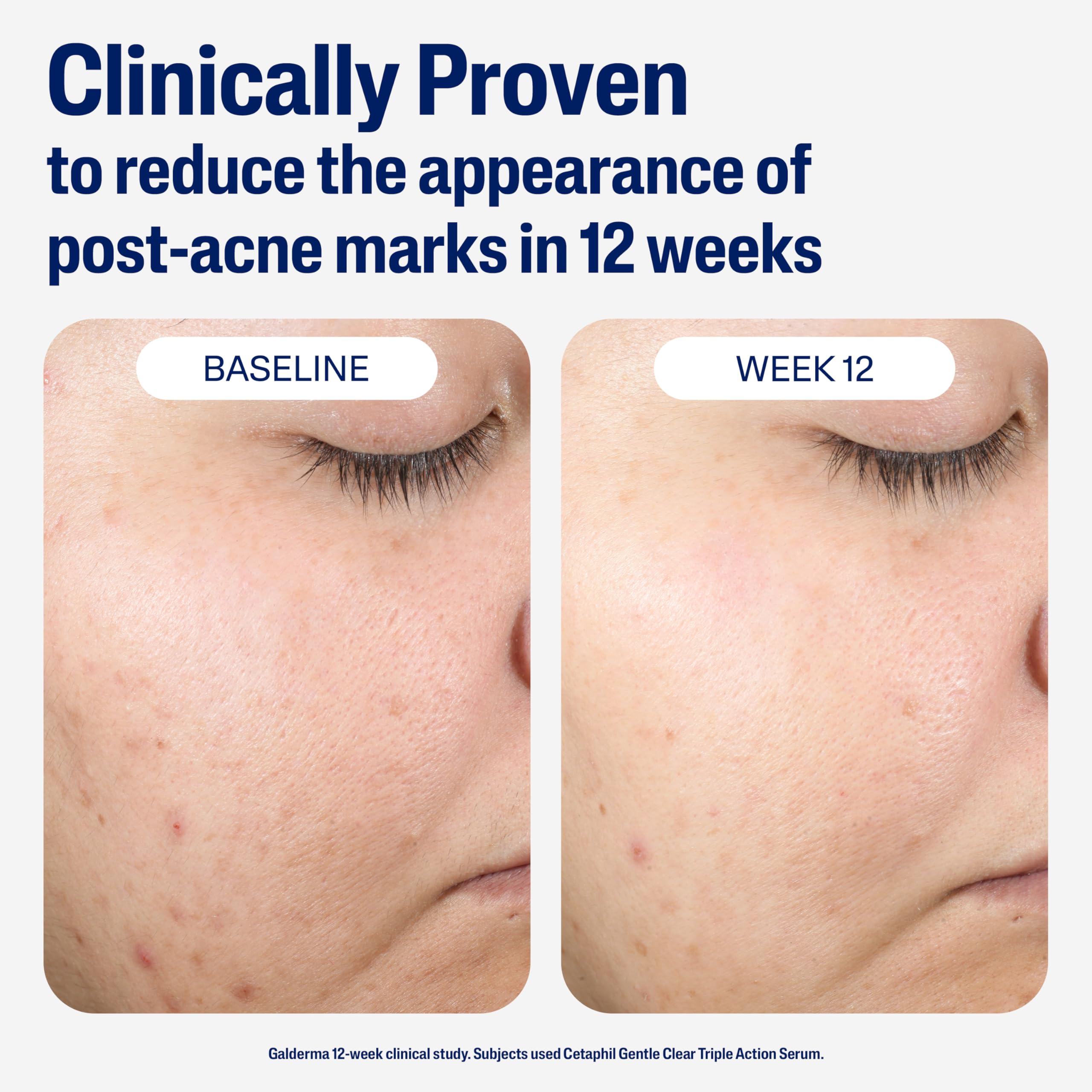 Cetaphil serum texture close-up demonstrating non-greasy, breathable feel.