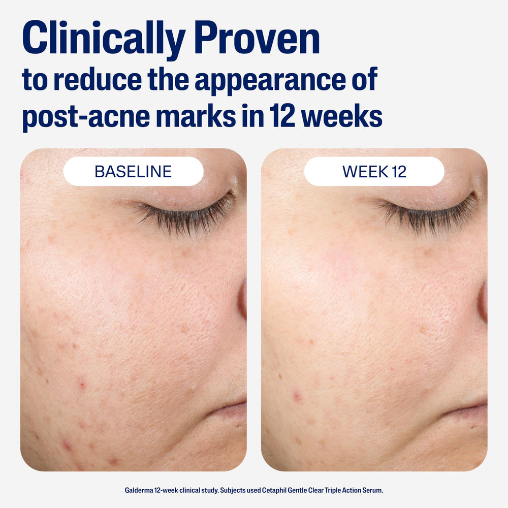 Cetaphil serum texture close-up demonstrating non-greasy, breathable feel.