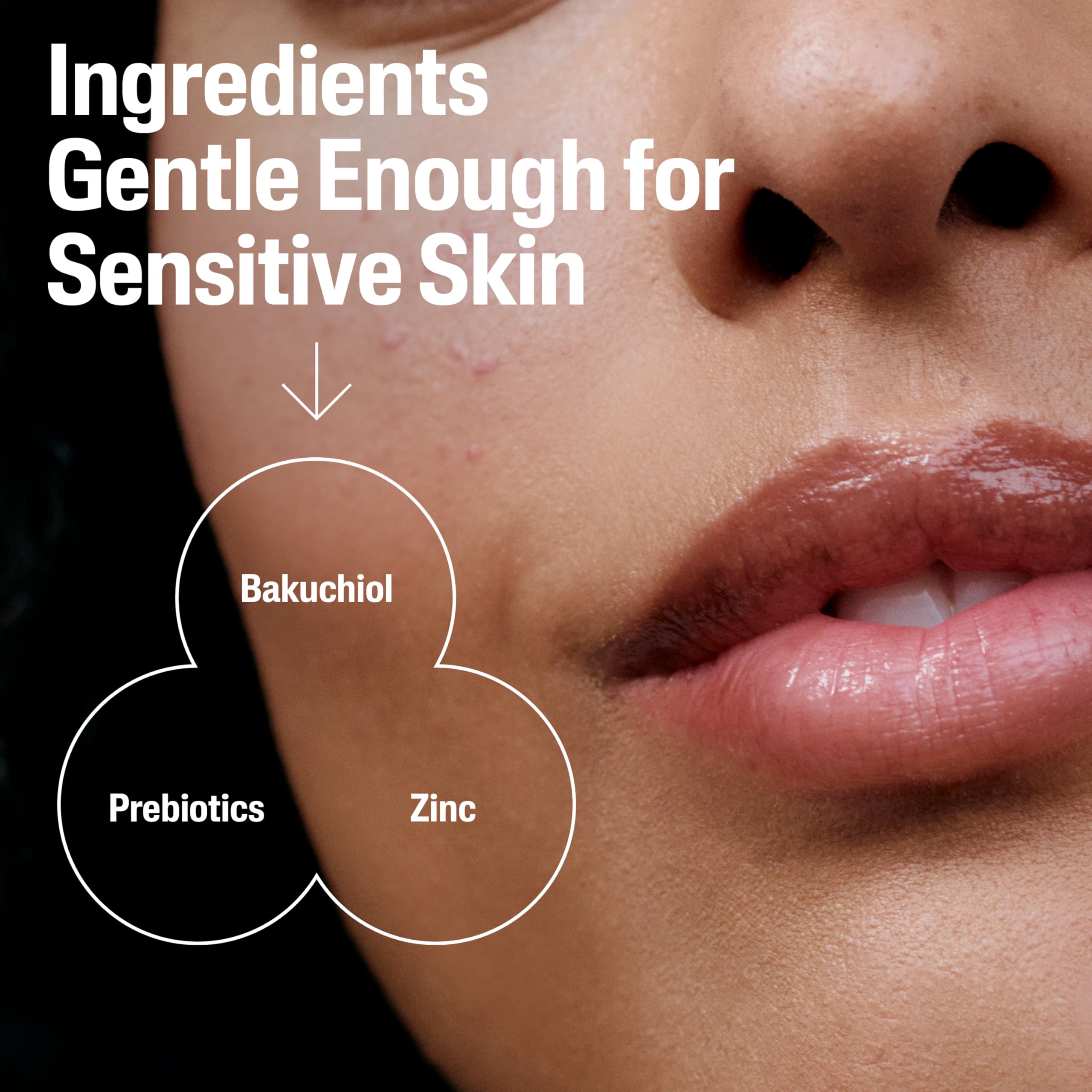 Cetaphil zinc and prebiotics image illustrating barrier support and oil balance.