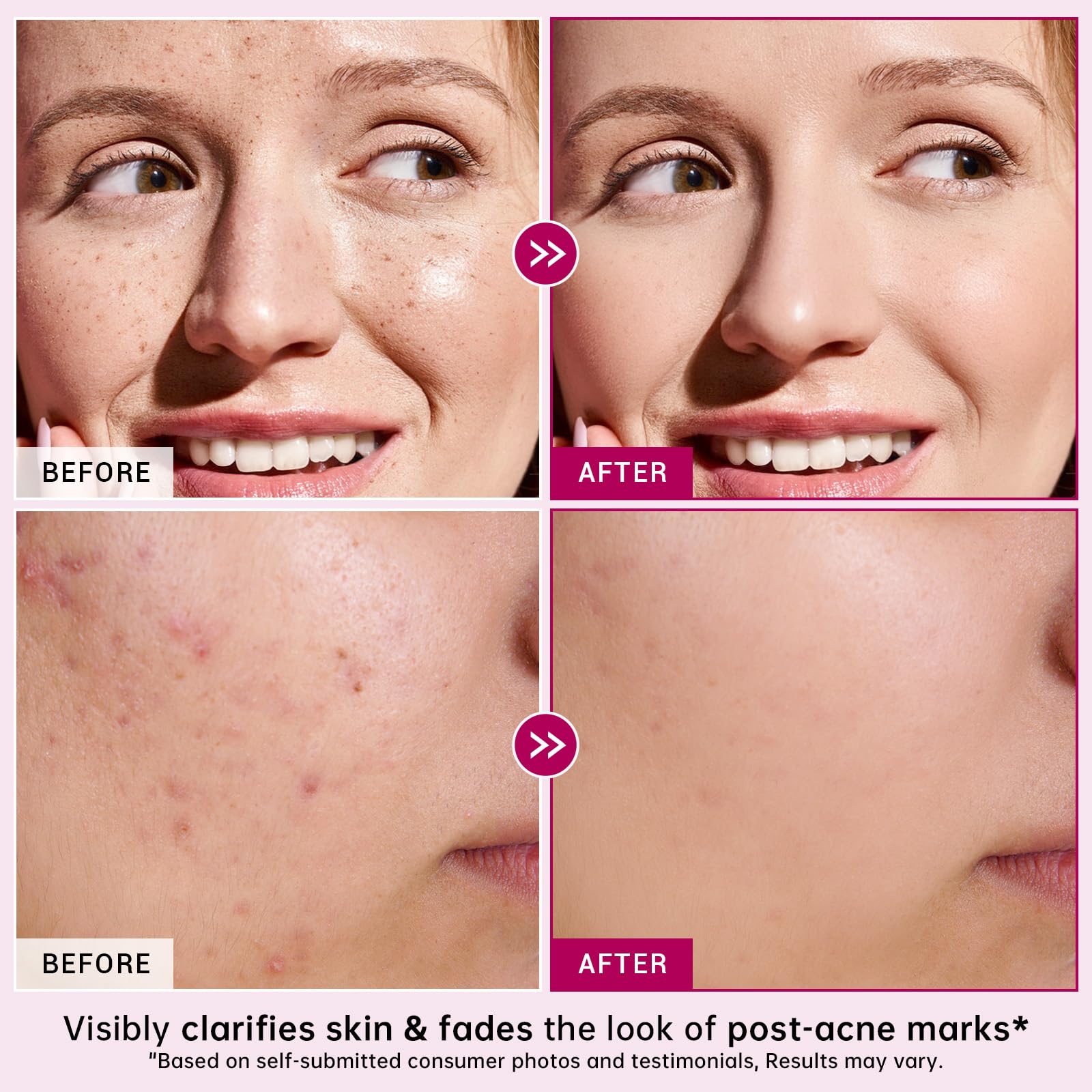 CHANGARLOAD cream swatches on forearm reveal gentle hydration and texture refinement