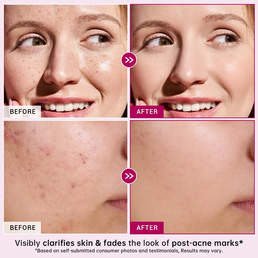 CHANGARLOAD cream swatches on forearm reveal gentle hydration and texture refinement