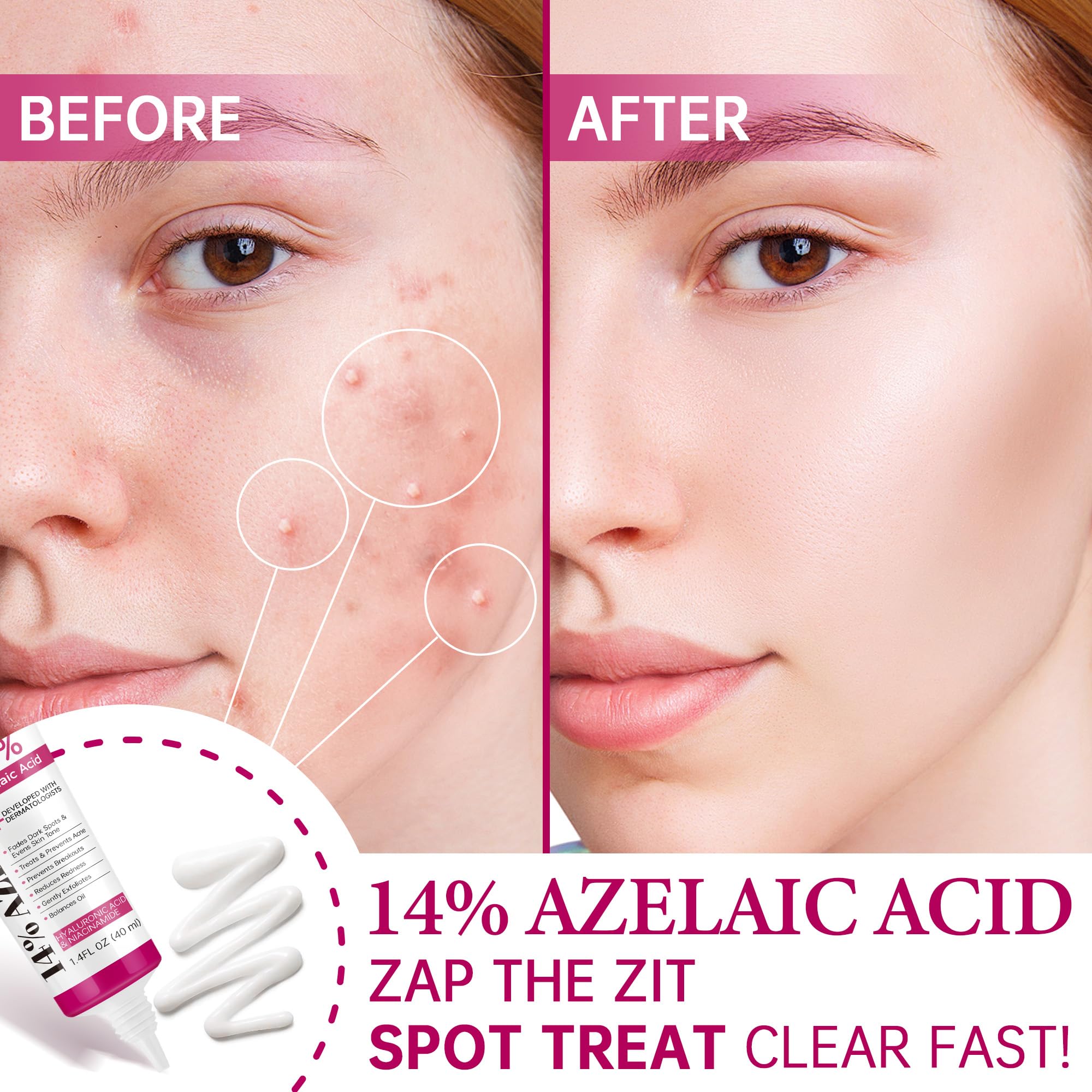 CHANGARLOAD niacinamide-centella swirl highlights balancing formula with hydrating benefits