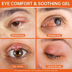 Changarload stye eye relief gel applied with fingertip for soothing comfort.