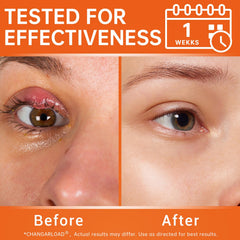 Changarload tea tree oil calendula vitamin E ingredients highlight natural eye care.