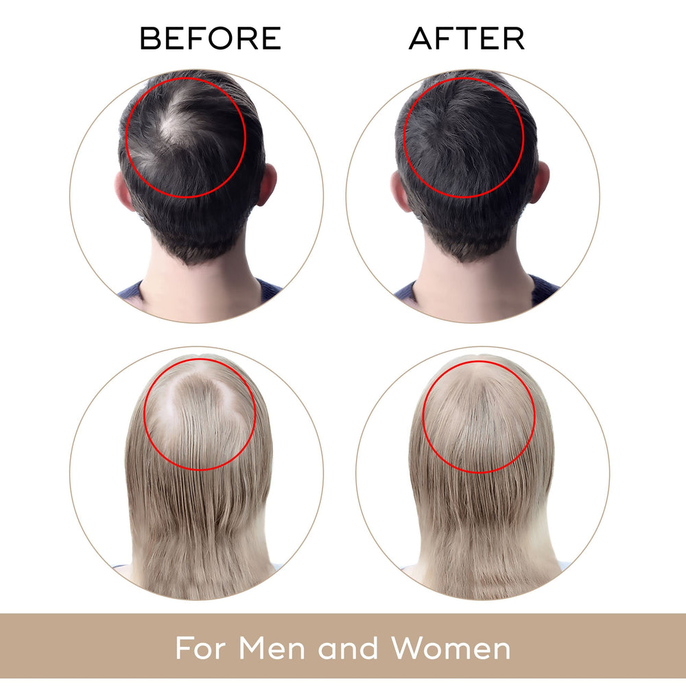 Charismo USA Dekohair bottle close-up highlighting natural ingredients for hair health