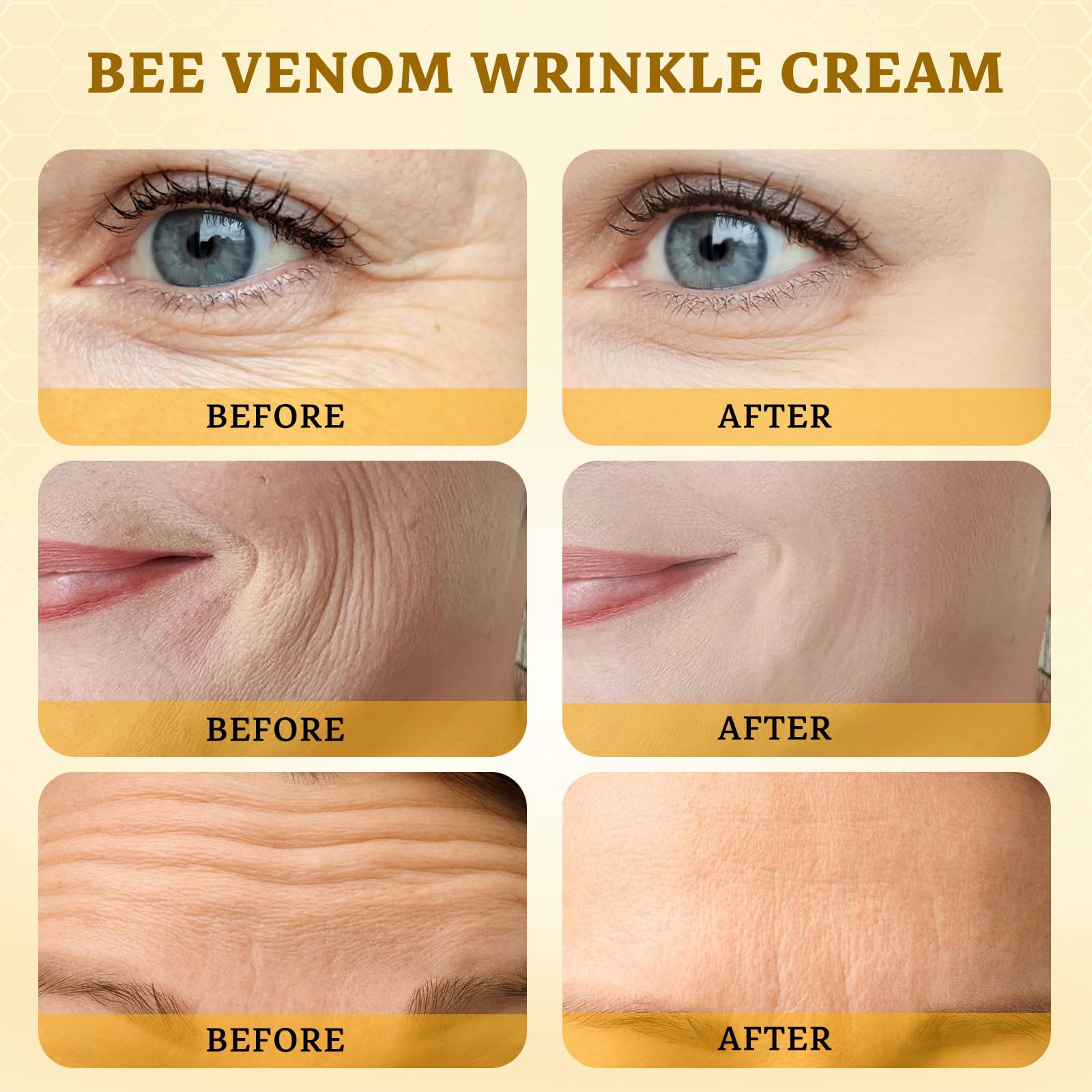 CHEOKINGBA Bee Venom Comprehensive Cream on hands for gentle nourishment