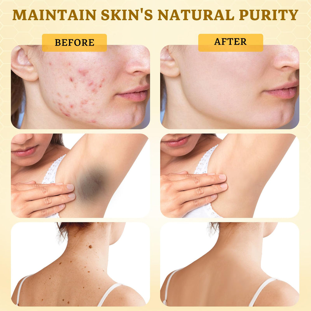 CHEOKINGBA Bee Venom Comprehensive Cream on neck area to soften lines