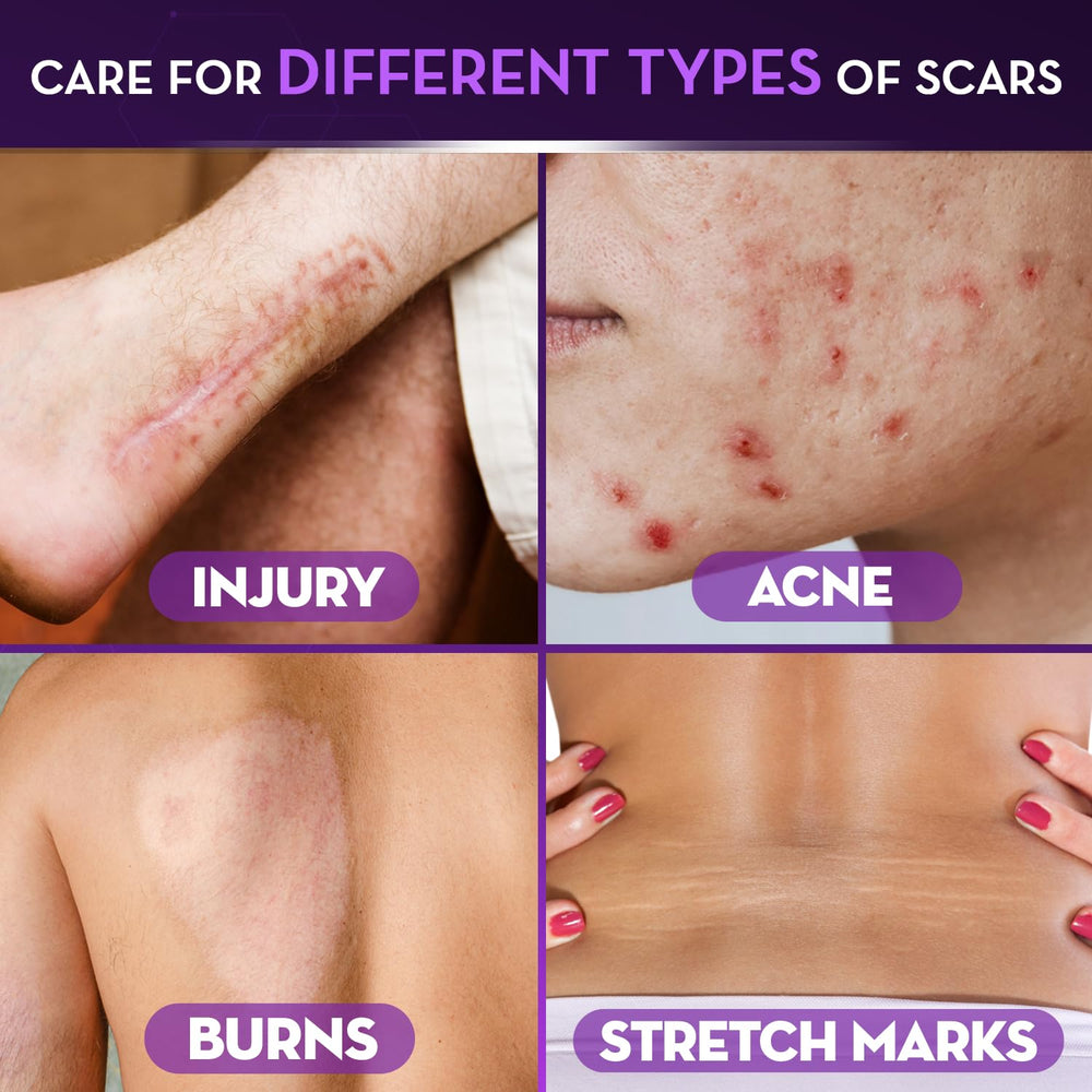 Cicatricure Advanced Scar Gel for face and body scar care