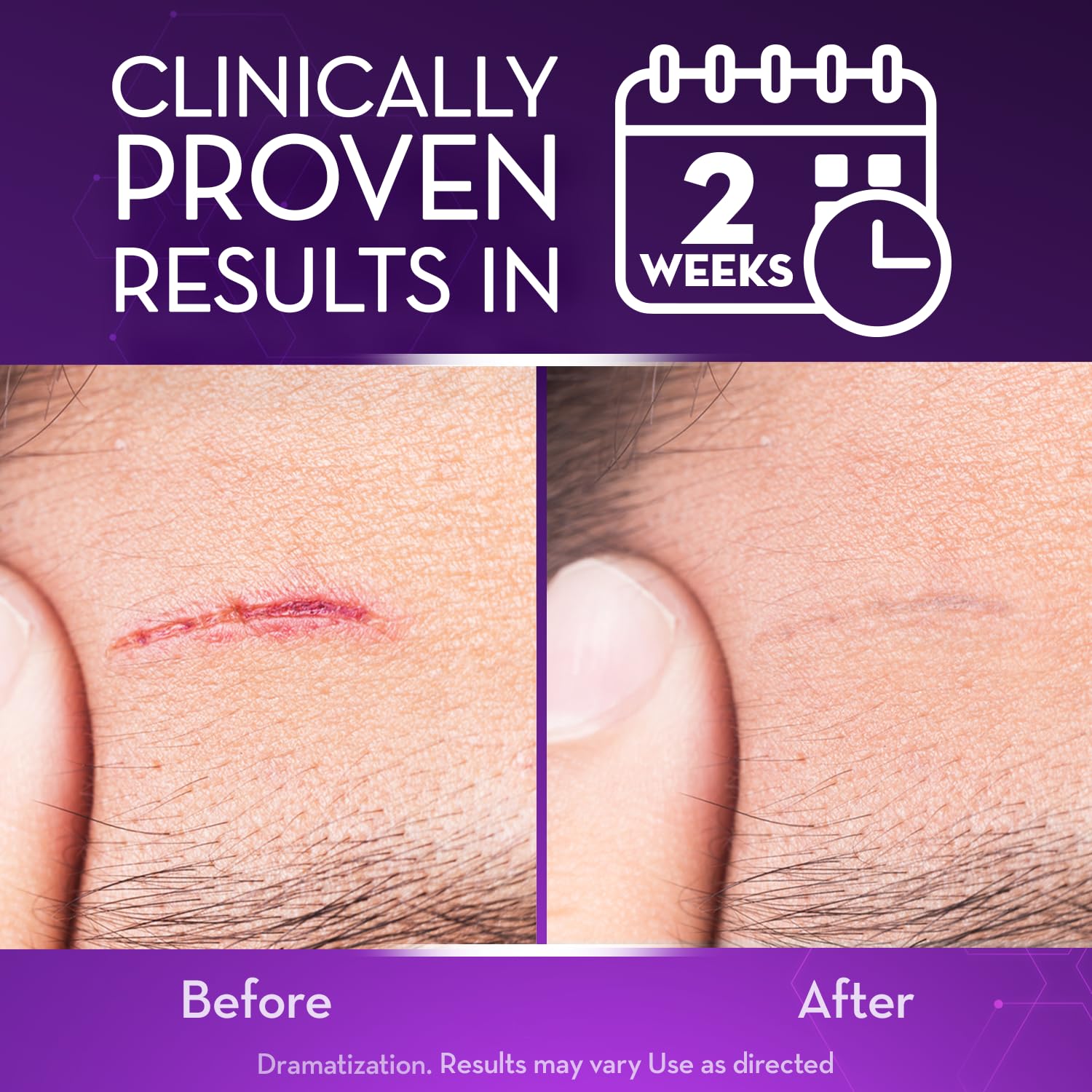 Cicatricure Advanced Scar Gel packaging highlighting Regenerare Complex ingredient