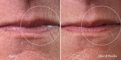 City Beauty City Lips Line Therapy application gesture suggests even coverage around the lip line.