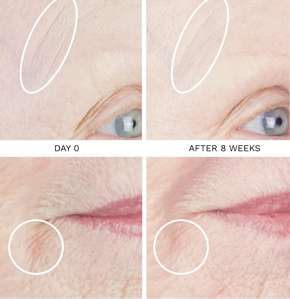 City Beauty UpLift Firming Serum dropper applying product for precise tightening