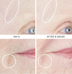 City Beauty UpLift Firming Serum dropper applying product for precise tightening