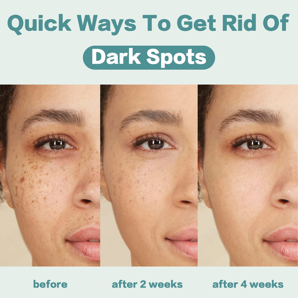 CITYGOO Dark Spot Remover application routine image shows daily care for a consistent complexion.