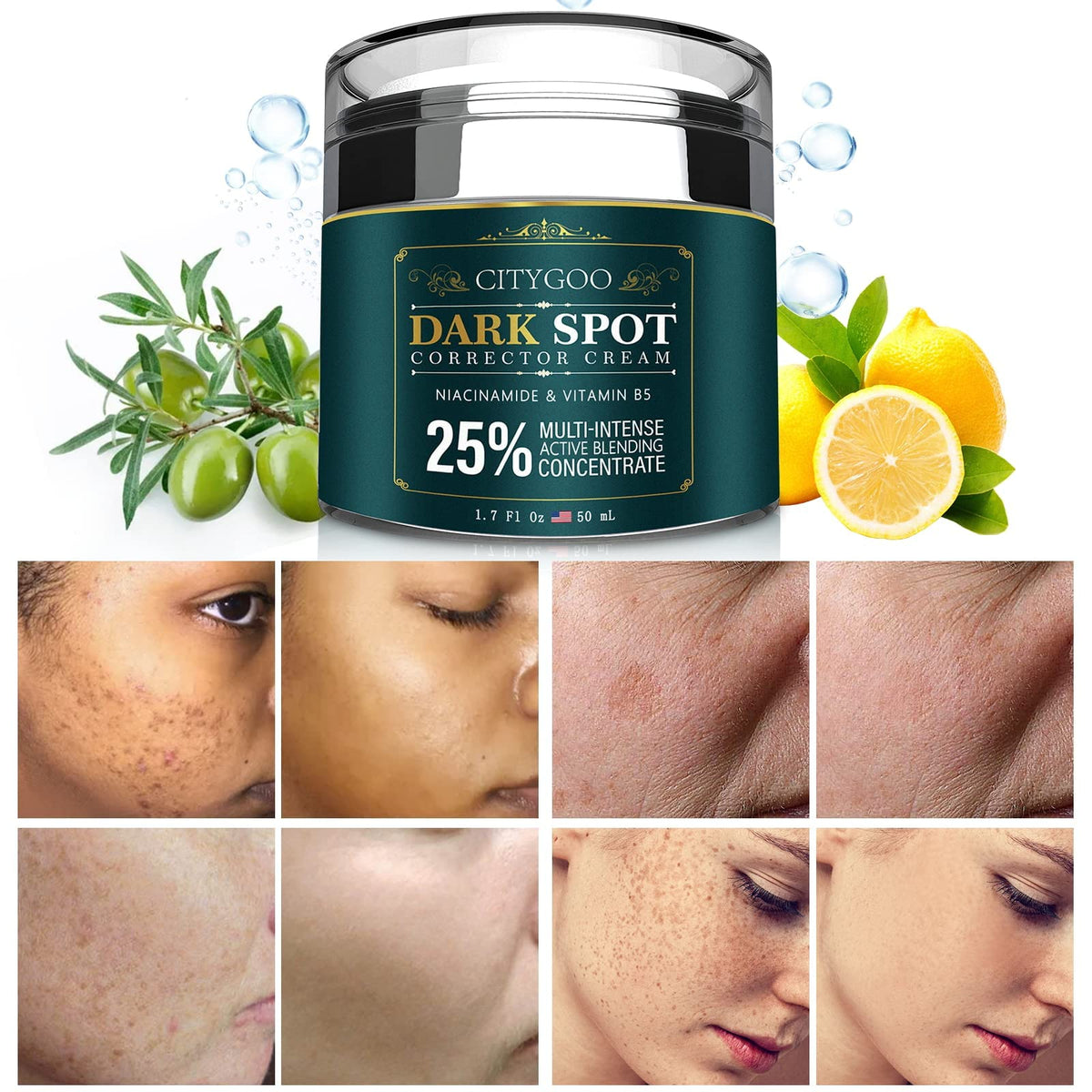 CITYGOO Dark Spot Remover bottle closeup illustrates premium packaging for even skin tone.
