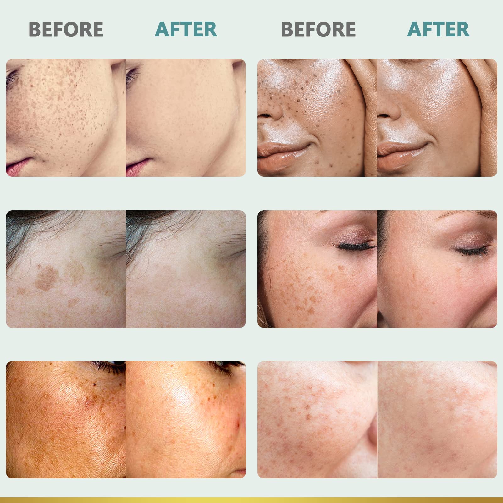 CITYGOO Dark Spot Remover day-use scene highlights protection against new spots.