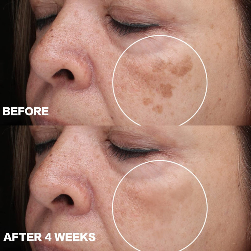 CITYGOO Dark Spot Remover night-use shot emphasizes skin's rhythm for renewal.