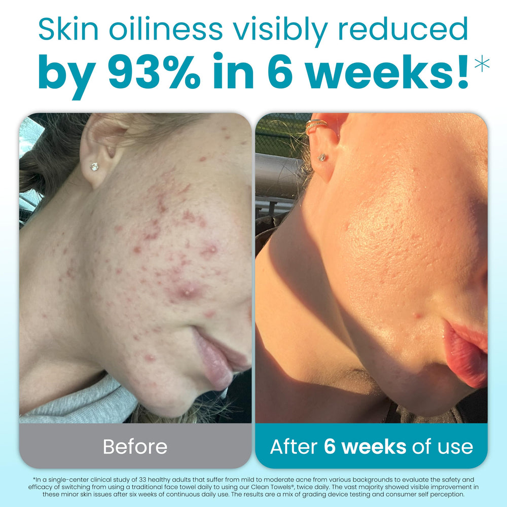 Clean Skin Club blemish towels XL exfoliating dot closeup for deeper cleansing.