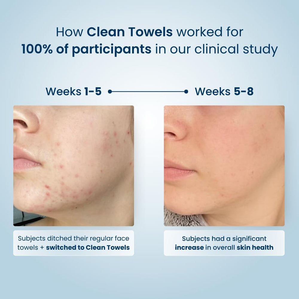 Clean Skin Club Clean Towels eczema-accepted logo — suitable for eczema-friendly routines.