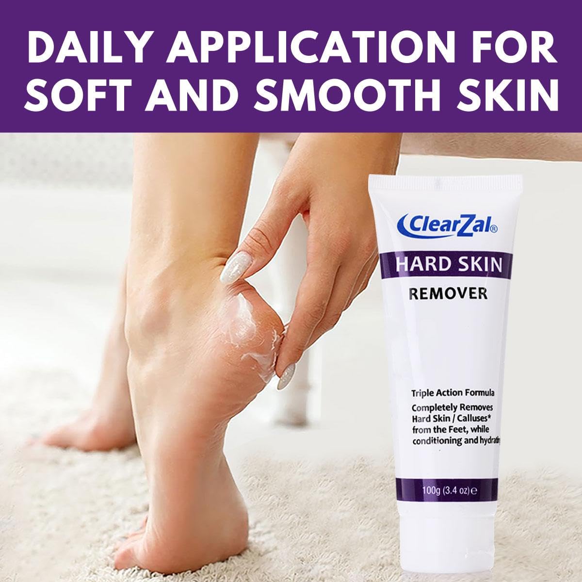 Clearzal Foot Cream sole closeup, hydration targets rough areas
