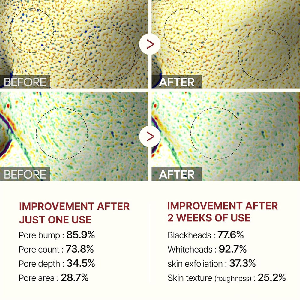 CLERVUN Rice Exfoliant bottle close-up highlights dual-action peel for smoother pores