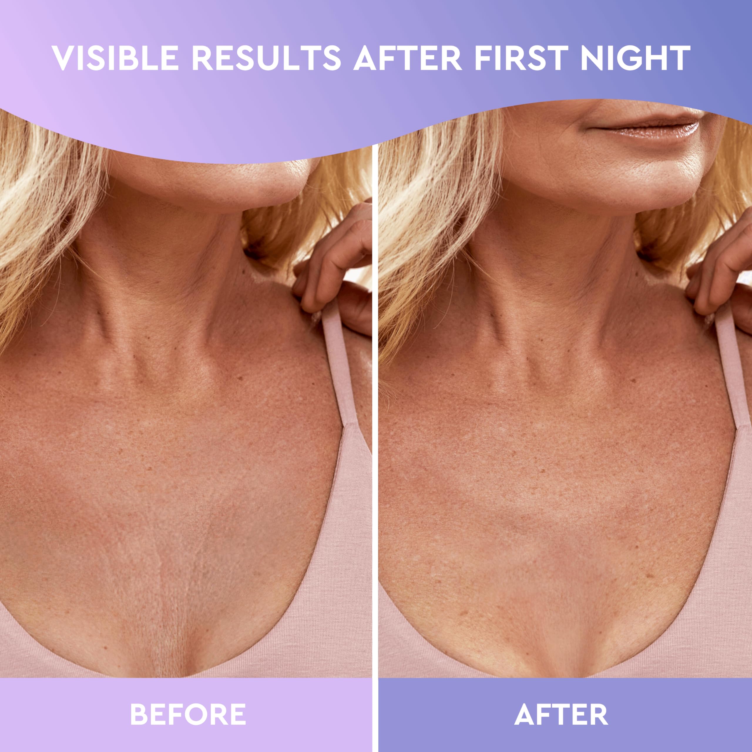 CLEVERFY silicone pads hydrate the skin and smooth lines.