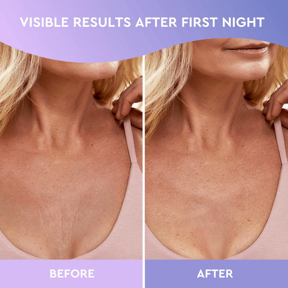 CLEVERFY silicone pads hydrate the skin and smooth lines.