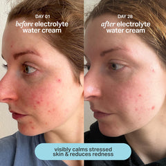 Cocokind Electrolyte Water Cream fragrance-free formula suitable for sensitive skin.