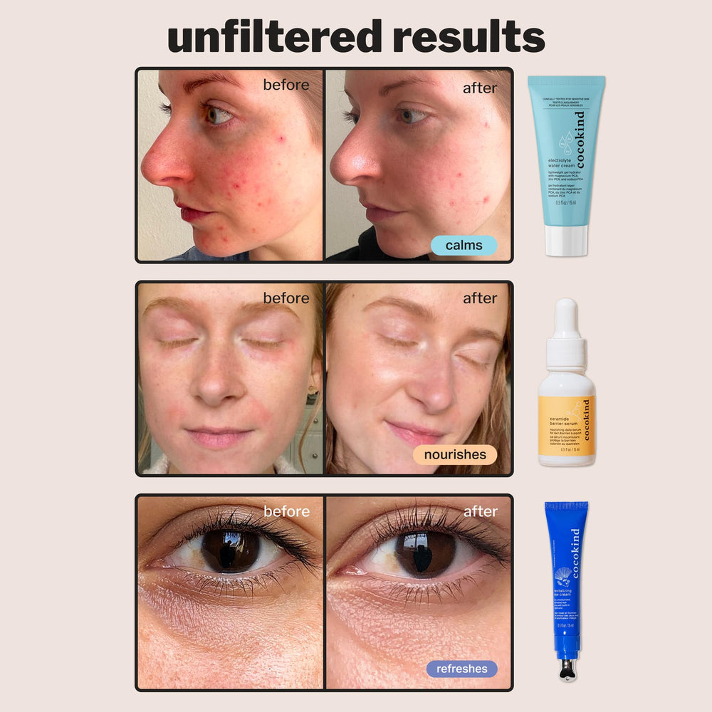 Cocokind Electrolyte Moisturizer provides lightweight hydration and soothing barrier support.