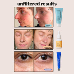 Cocokind Electrolyte Moisturizer provides lightweight hydration and soothing barrier support.
