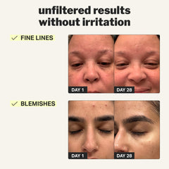 Cocokind Retinol Gel application swirl demonstrates soothing formula for sensitive skin relief.