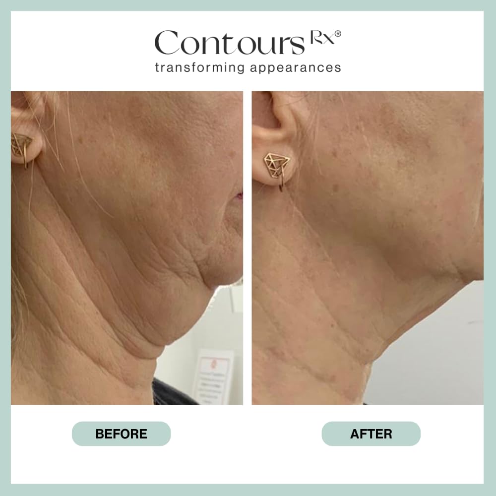 Contours Rx Neck Rescue hypoallergenic materials support irritation-free wear for sensitive skin.