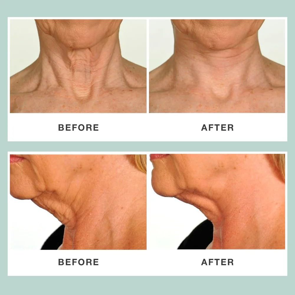 Contours Rx Neck Rescue invisible-design under clothes emphasizes confidence with a seamless wear during events.